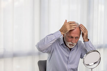 senior-man-hair-loss